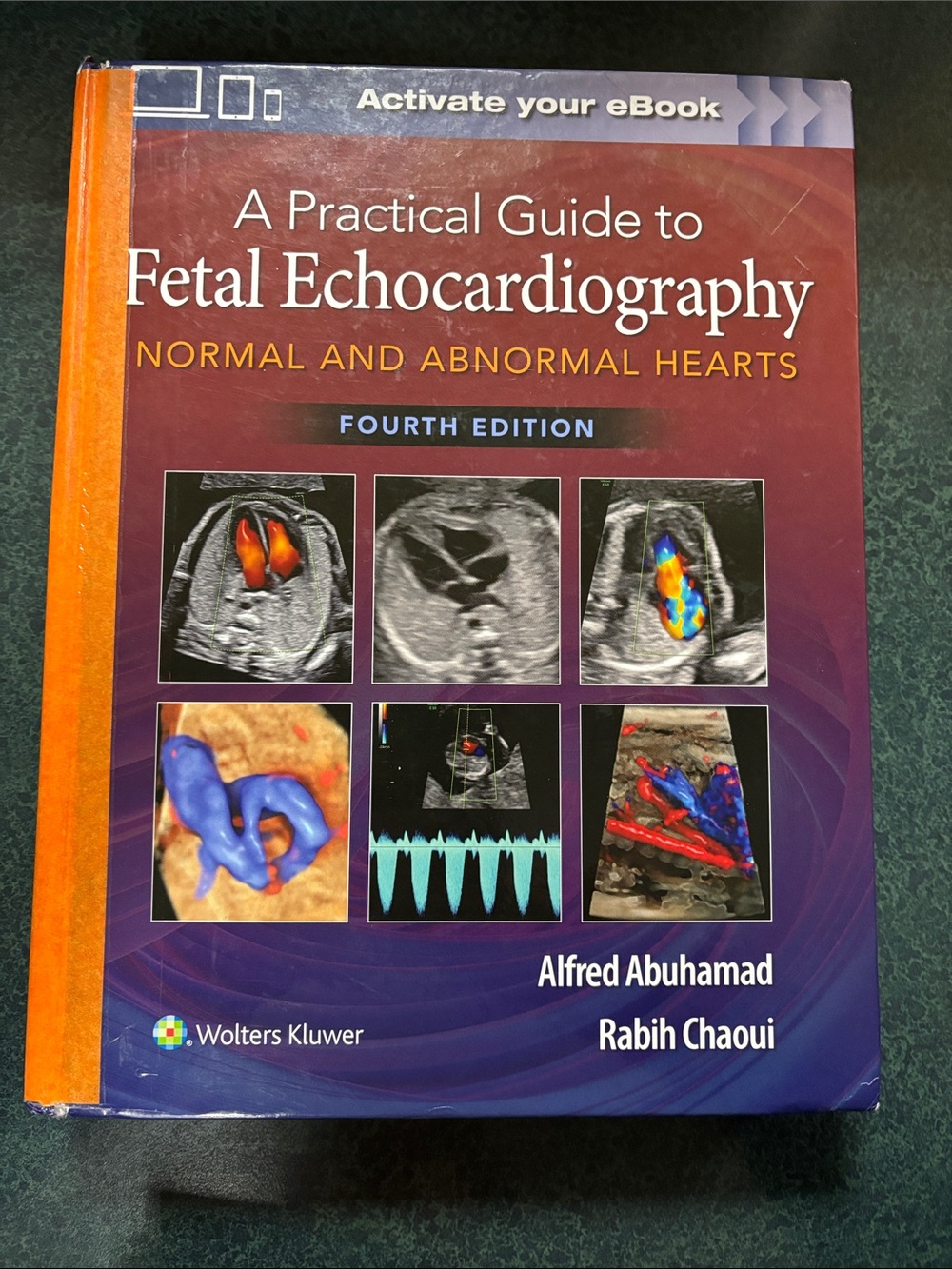 Fetal Echo text book